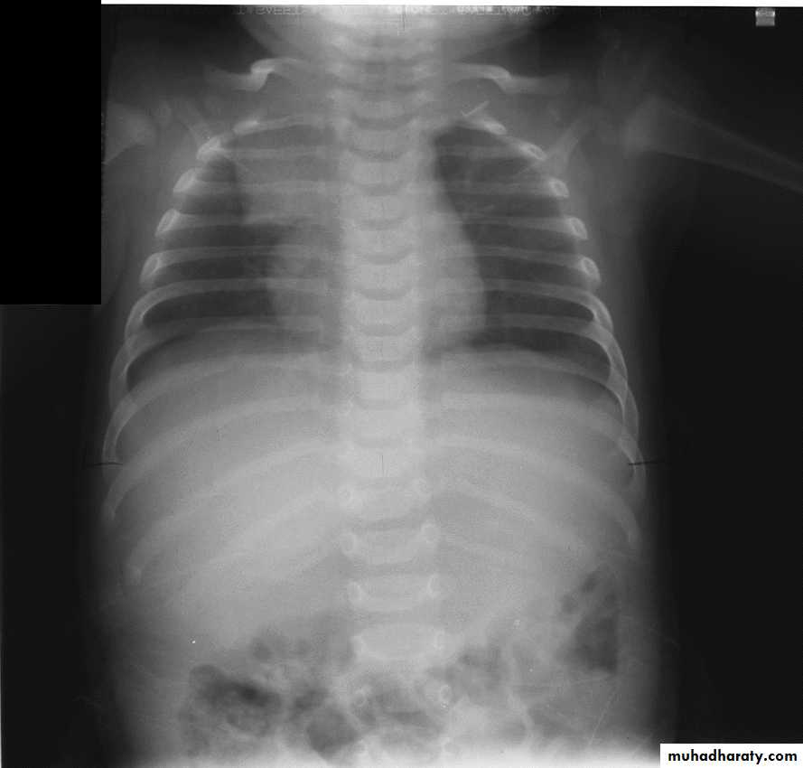 Chest investigations