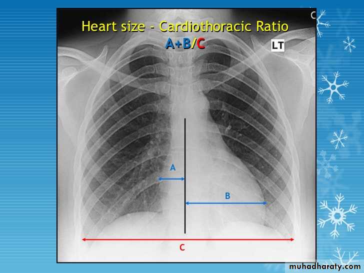 Chest investigations