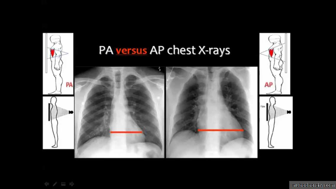 Chest investigations