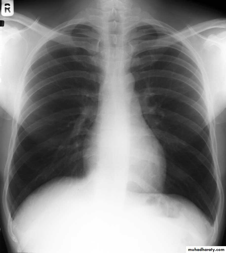 Chest investigations