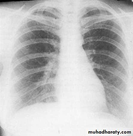 Chest investigations