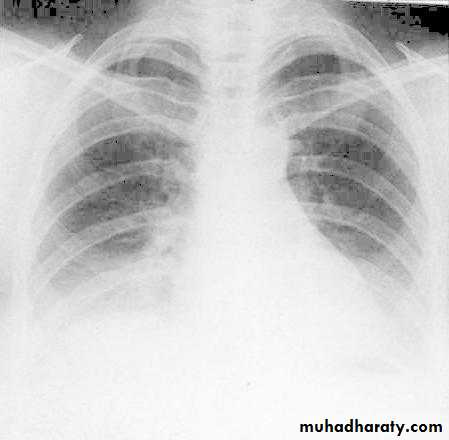 Chest investigations
