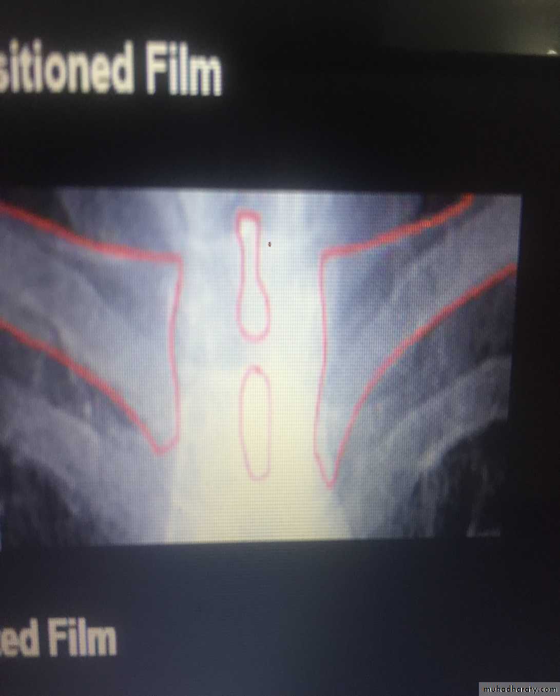 Chest investigations