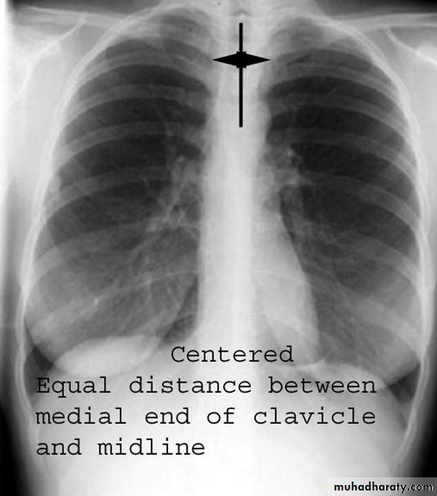 Chest investigations