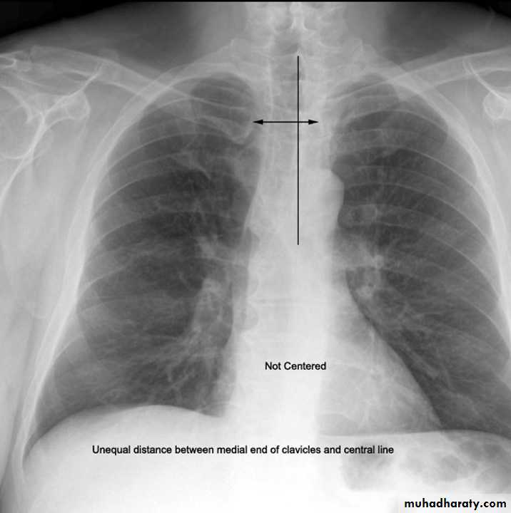 Chest investigations