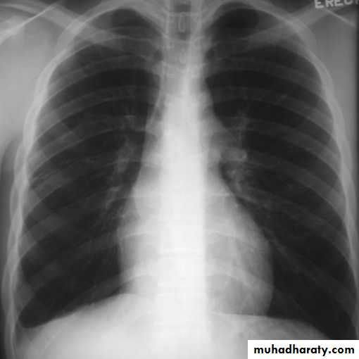 Chest investigations