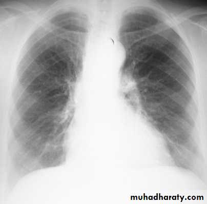 Chest investigations