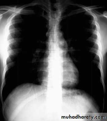 Chest investigations