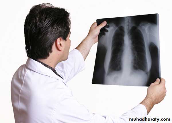 Chest investigations