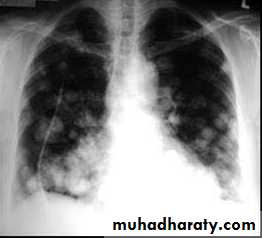Chest investigations