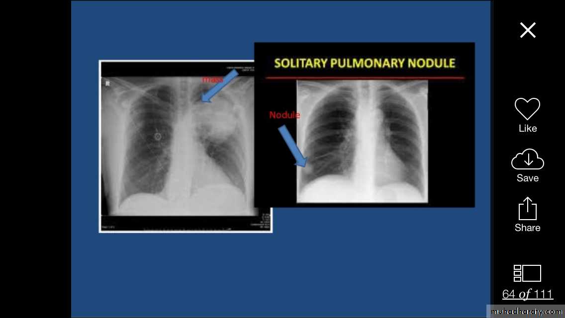 Chest investigations