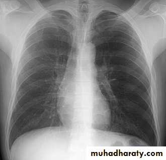 Chest investigations