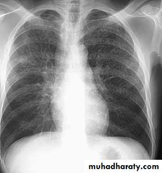Chest investigations