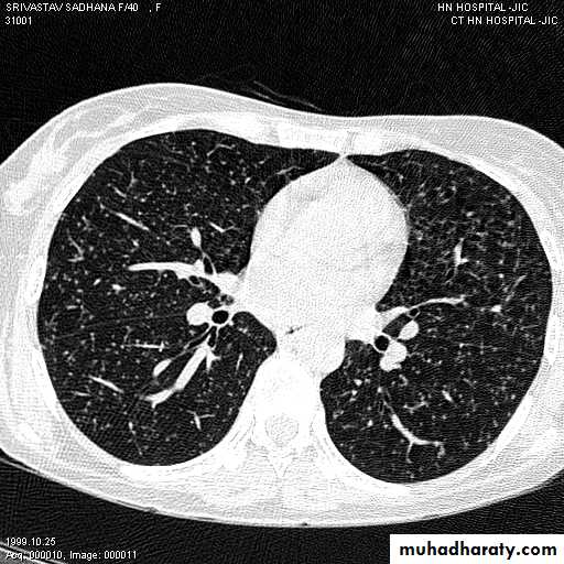Chest investigations