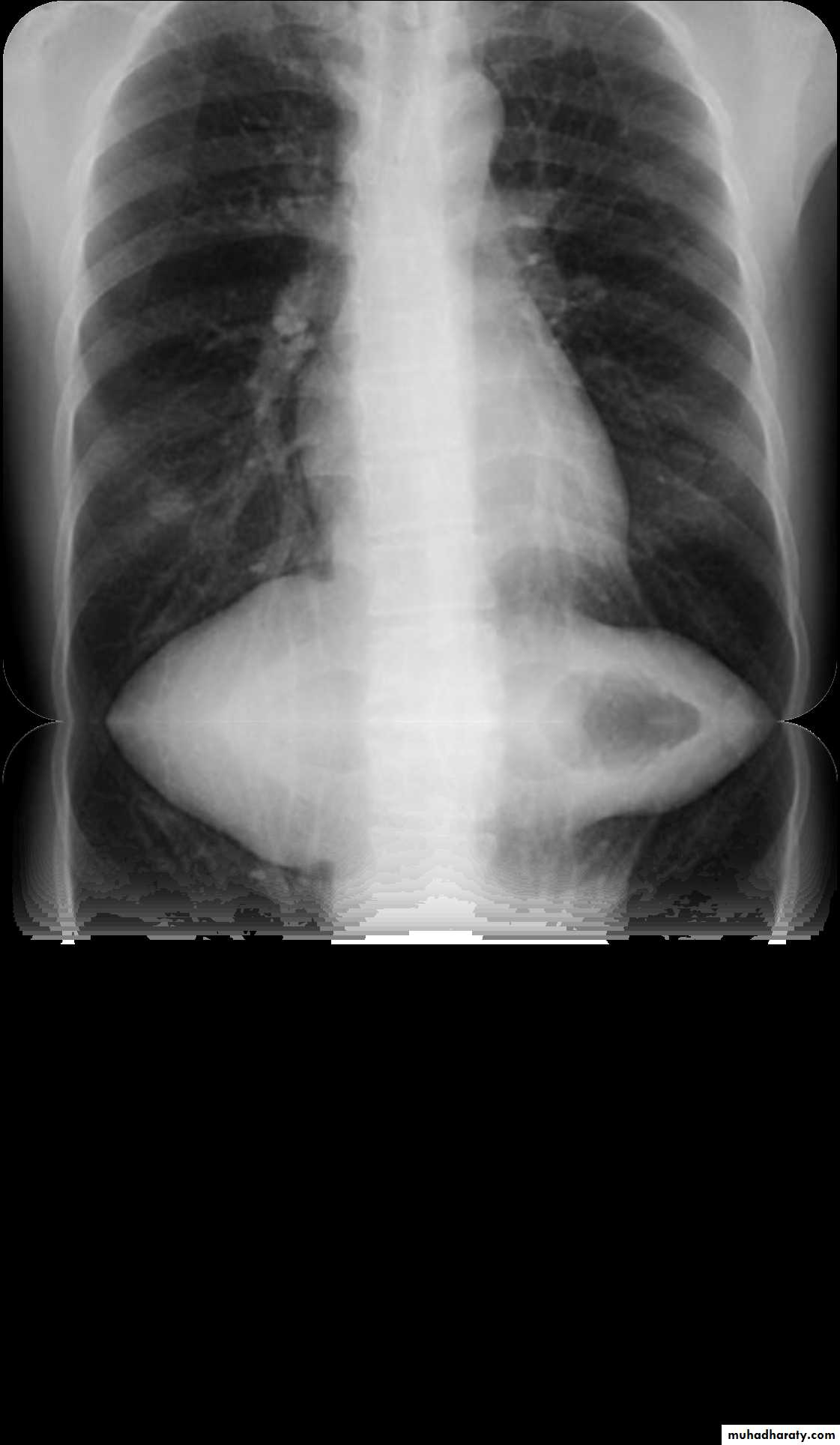 Chest investigations