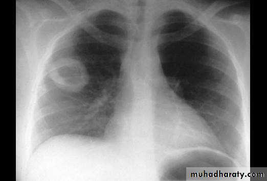 Chest investigations