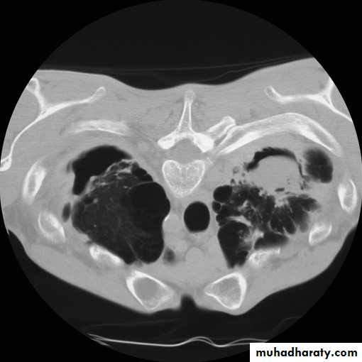 Chest investigations