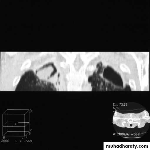 Chest investigations