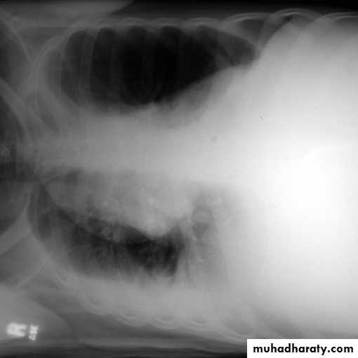 Chest investigations