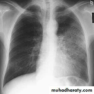 Chest investigations