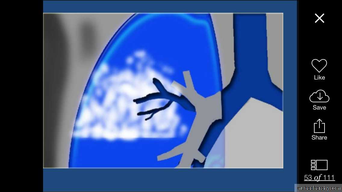 Chest investigations