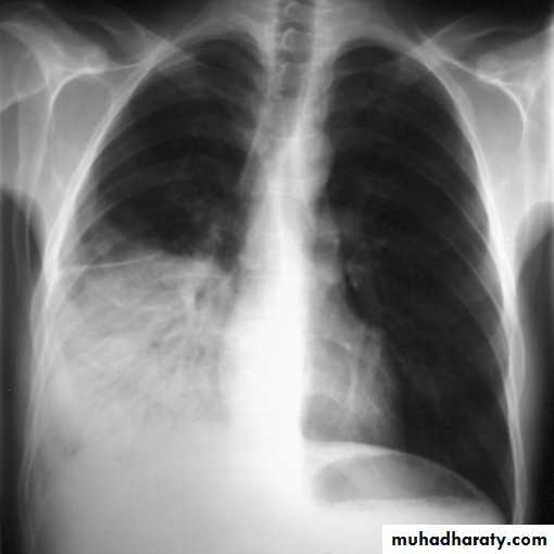 Chest investigations