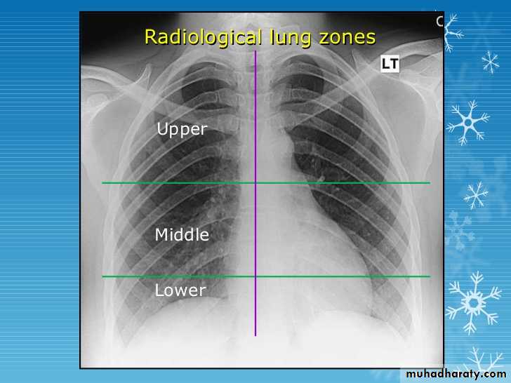 Chest investigations