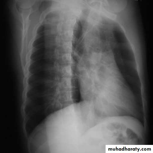 Chest investigations