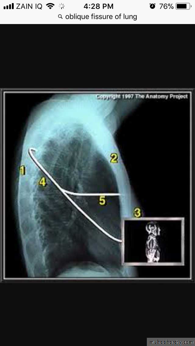 Chest investigations