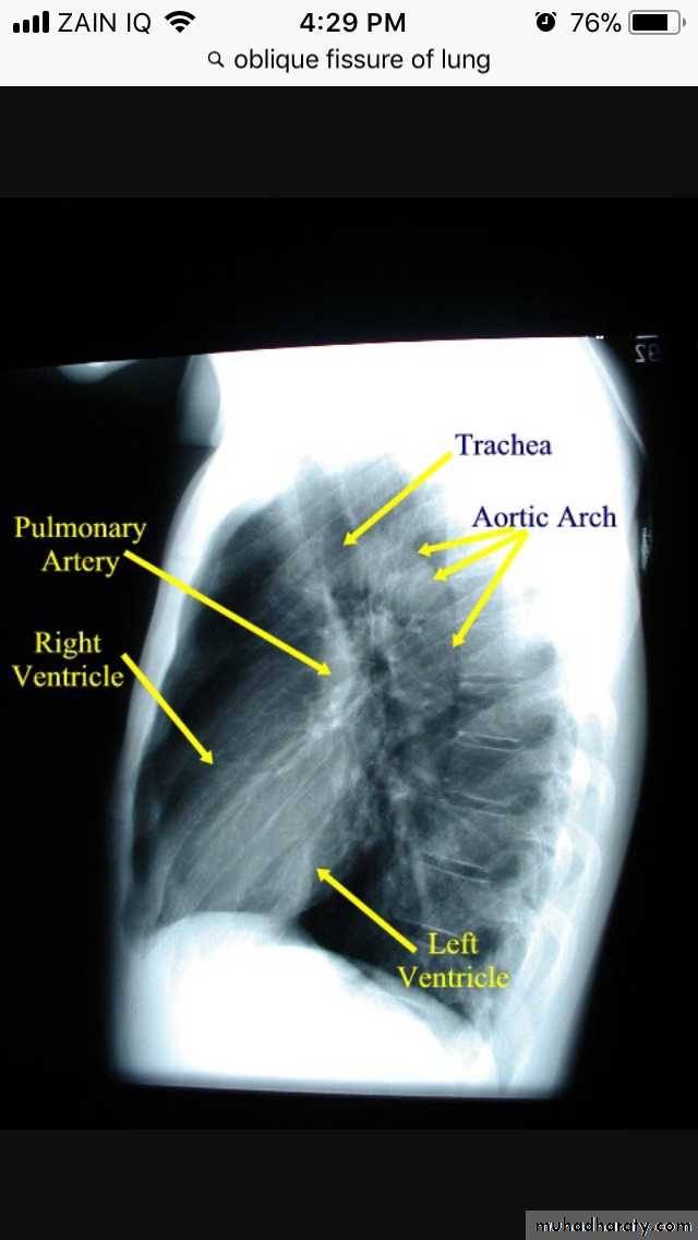 Chest investigations