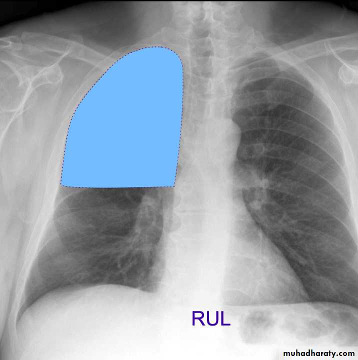 Chest investigations