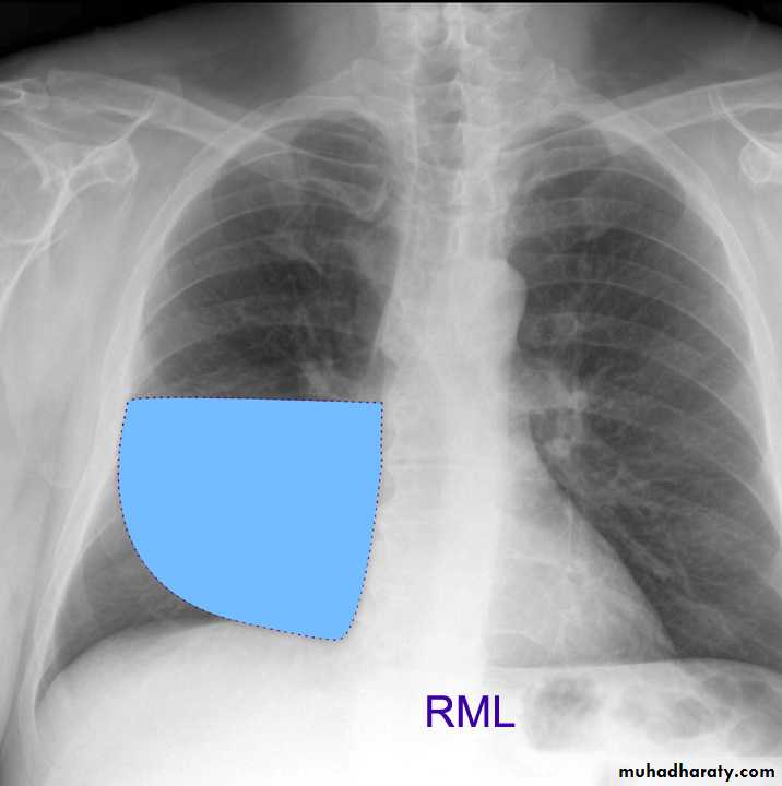 Chest investigations