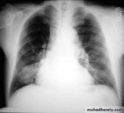 Chest investigations