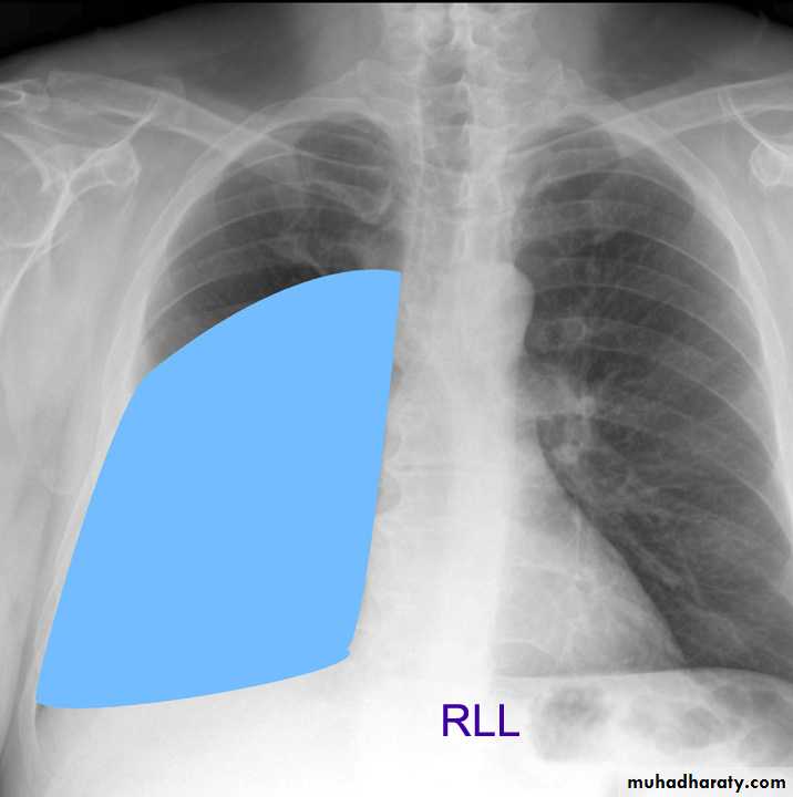 Chest investigations
