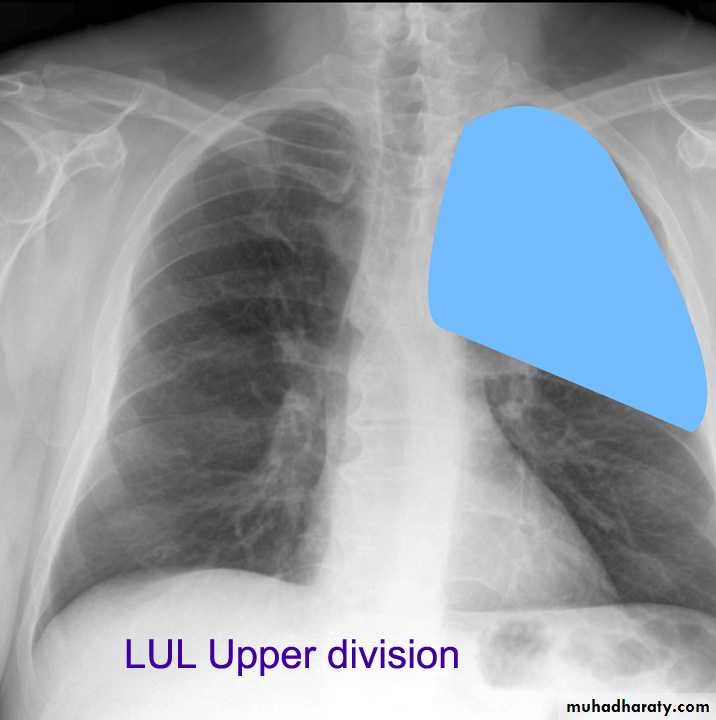 Chest investigations
