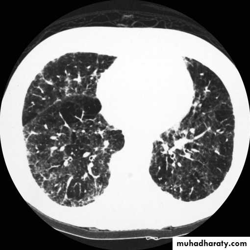 Chest investigations