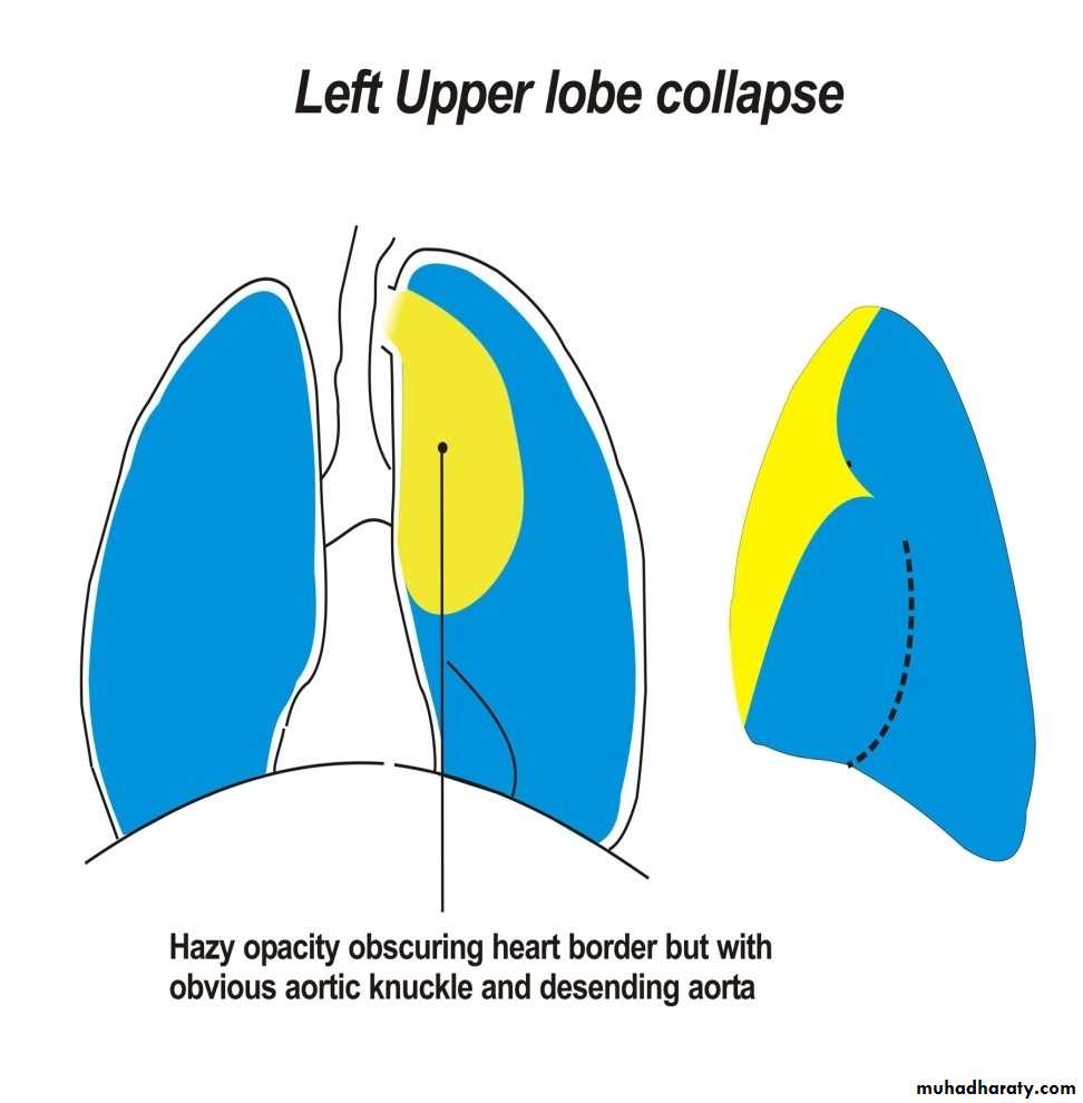 Chest investigations