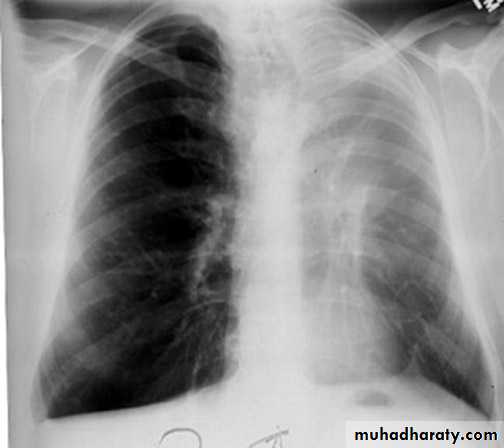 Chest investigations