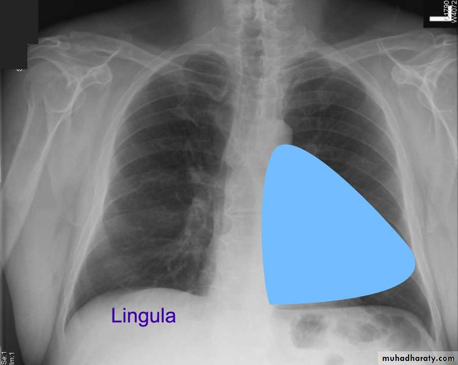 Chest investigations
