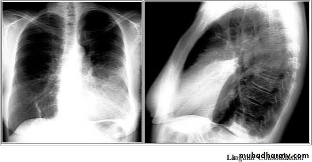 Chest investigations