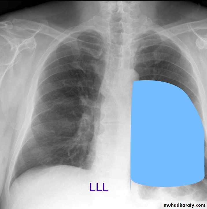 Chest investigations