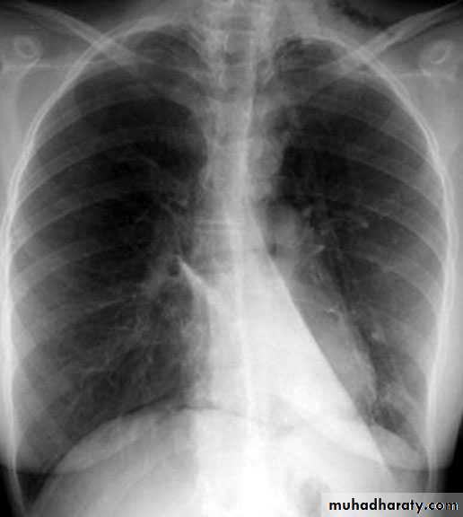 Chest investigations
