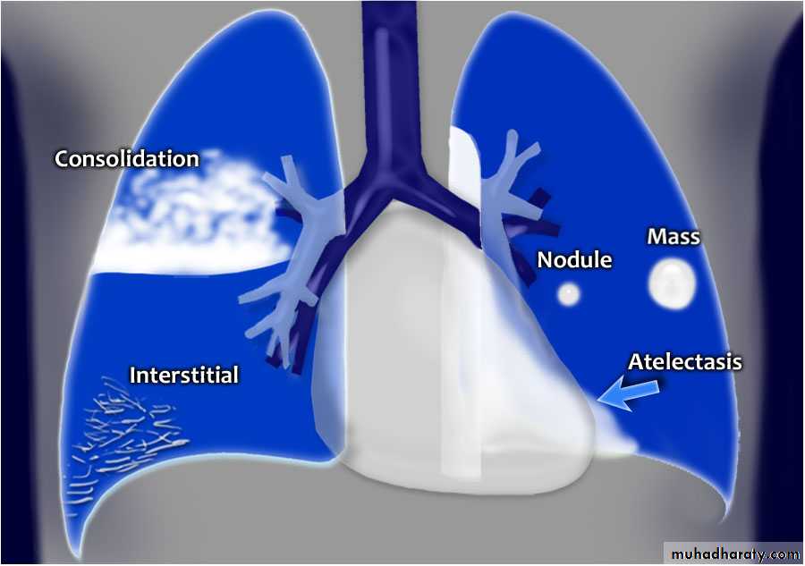 Chest investigations
