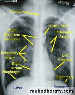 Chest investigations