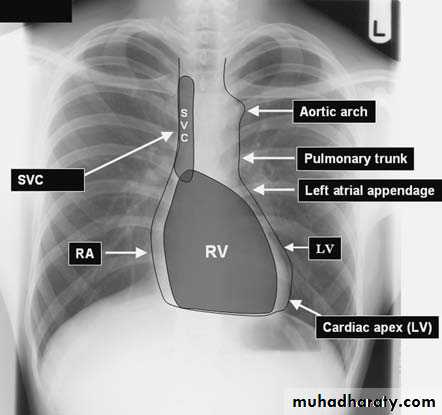 Chest investigations