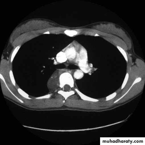 Chest investigations