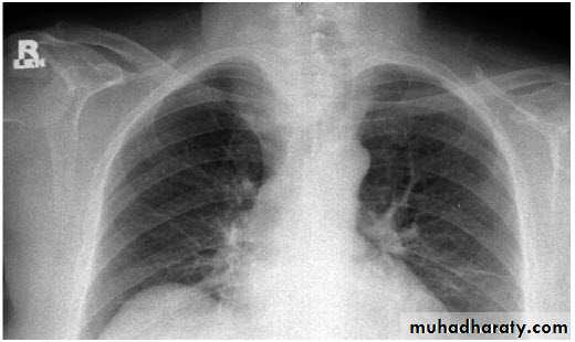 Chest investigations