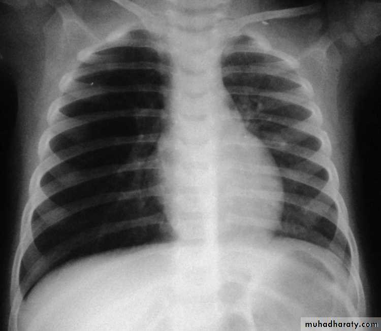 Chest investigations