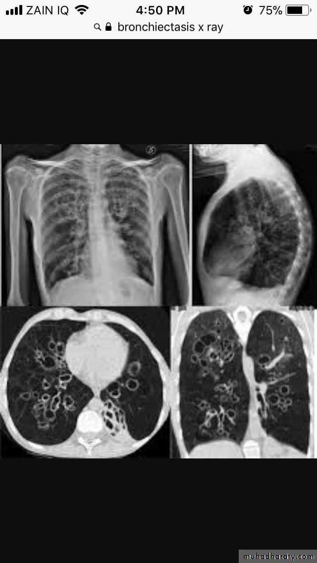 Chest investigations