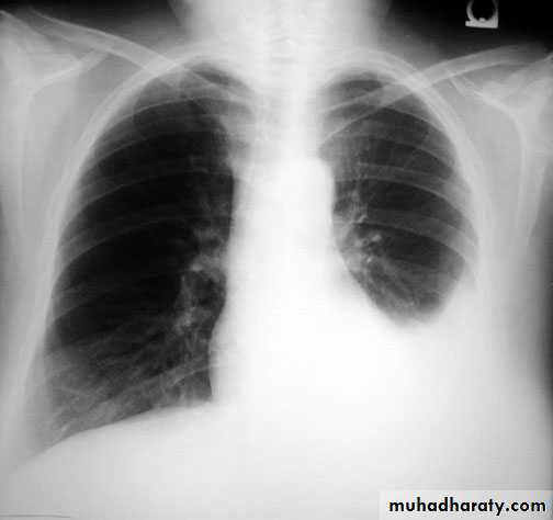 Chest investigations